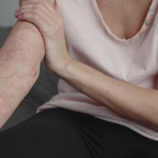 Stressed Skin? How Stress Affects Your Skin and What You Can Do Naturally