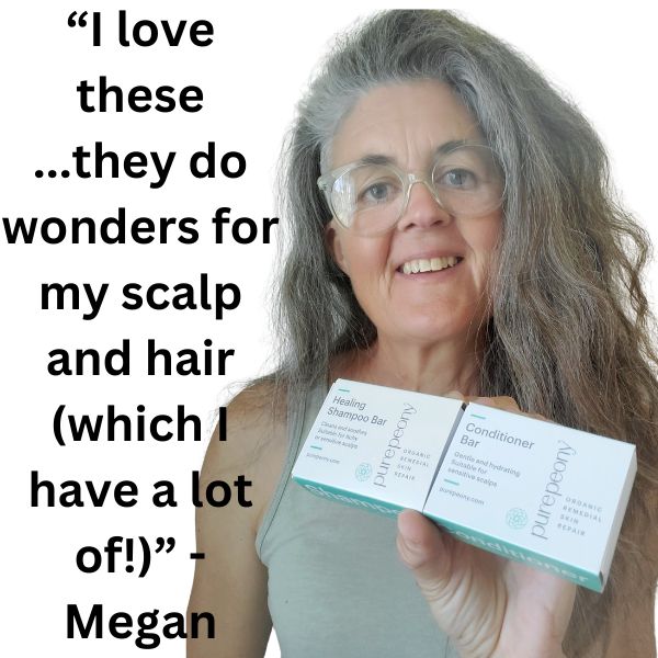 customer photo with psoriasis shampoo bar