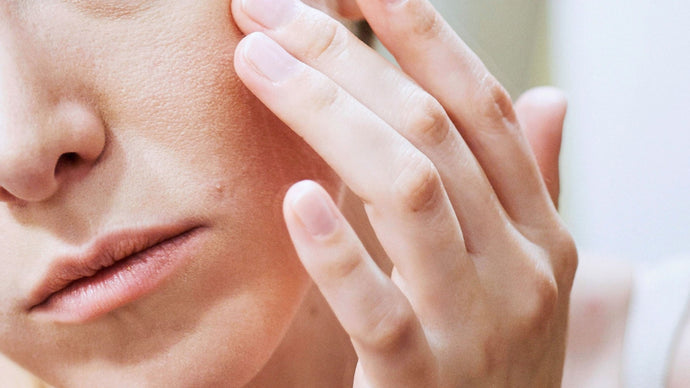 Face Eczema: Soothe Skin & Regain Confidence!