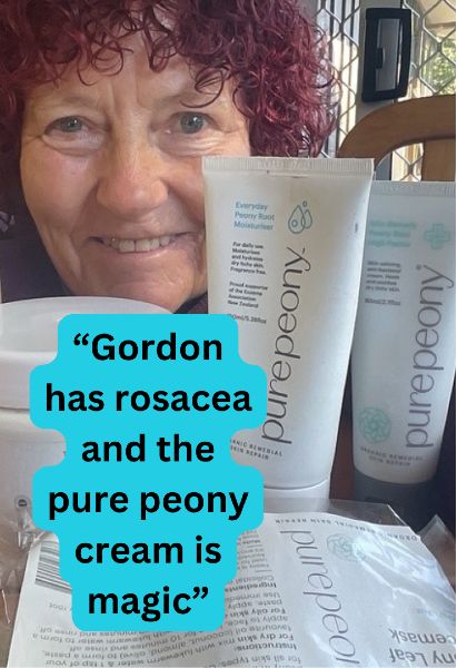 customer photo of natural rosacea peony skincare