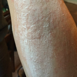 High Factor Peony Root Skin Cream for Eczema Relief